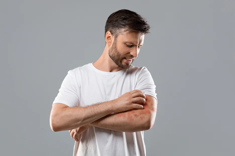 a man scratching the itchiness on his skin