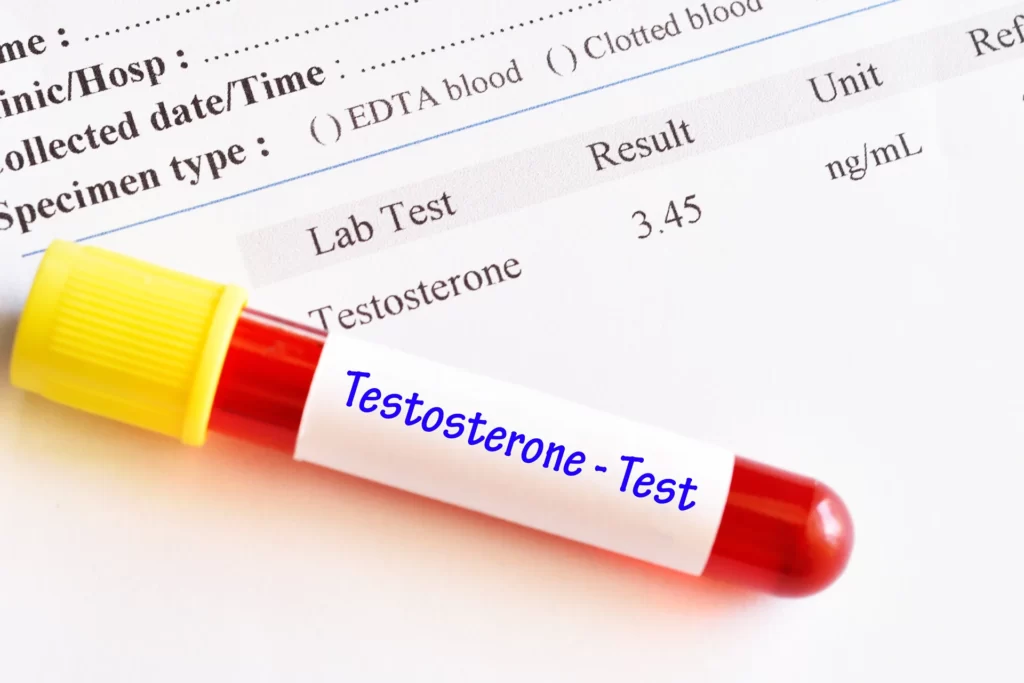 testosterone test results
